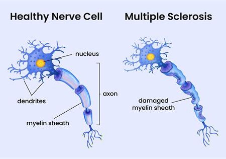 Vital Collagen Peptides Market Data 2026: Growth Trends, Research Insights & Product Comparison Guide